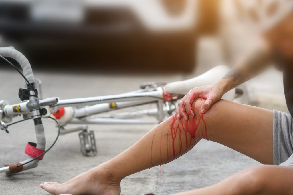 Accident car crash with bicycle on road